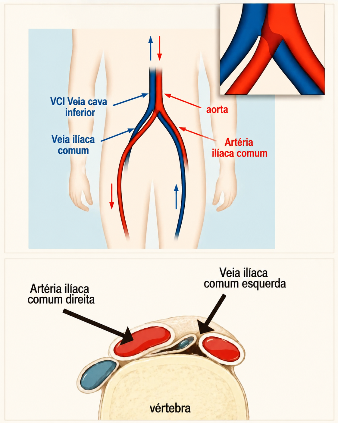 Esquema anatômico da veia cava inferior, veias e artérias ilíacas comuns e corte transversal na altura da vértebra